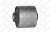 STELLOX 7700435SX 77-00435-SX_с/б зад.прод.рычага/Toyota Land Cruiser Prado 120 GRJ12#/KDJ12#/RZJ12#/TRJ12#/VZJ12#&lt;09